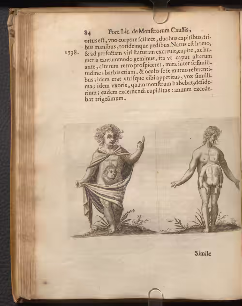 The two-headed man